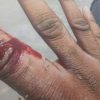 Driver Jailed 9 Months For Biting Officer’s fingers